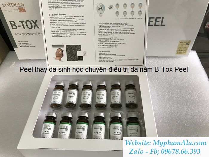 20170505_170657_B-Tox_Peel_chuyen_dieu_tri_da_nam_result