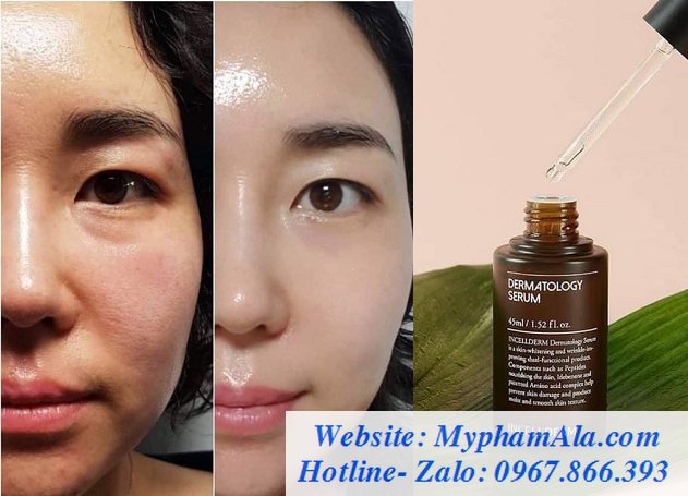 Set-duong-da-incellderm-dermatology-631x455