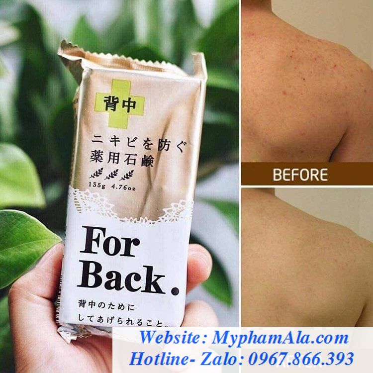 soap-xa-phong-tri-mun-lung-for-back-nhat-1