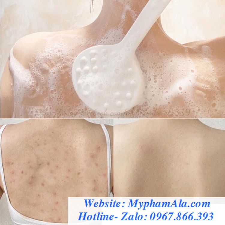 sua-tam-tri-mun-some-by-mi-30-days-miracle-acne-clear-body-cleanser