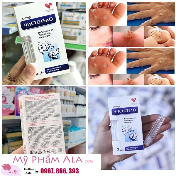 gel-dvelinil-tay-not-ruoi-mun-coc-mun-thit-cua-nga-600x600-1