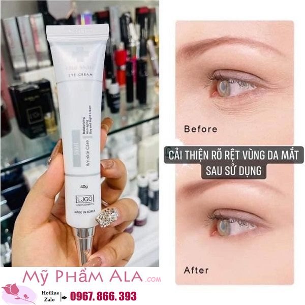 kem-mat-ljgo-snail-wrinkle-care-cha-skin-eye-cream