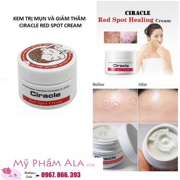 kem-tri-mun-ciracle-red-spot-cream-cho-da-mun
