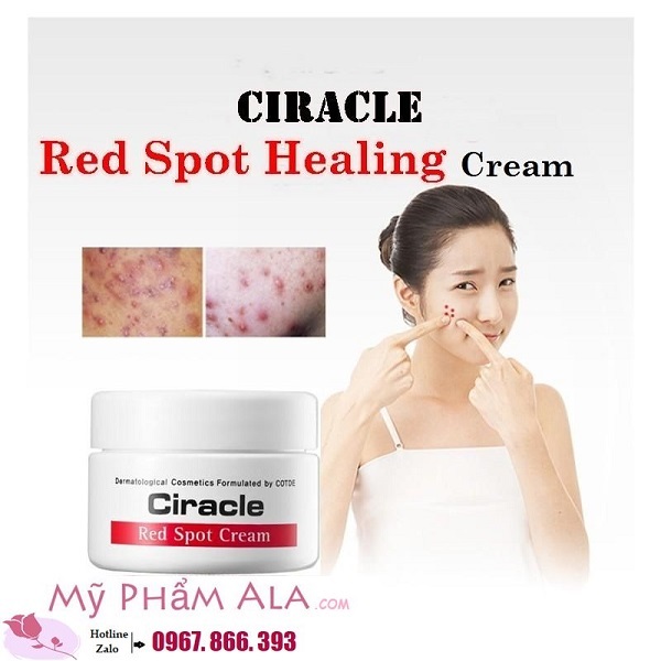 kem-tri-mun-va-giam-tham-ciracle-red-spot-cream-600x600-57.7kb