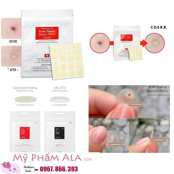 mieng-dan-mun-cosrx-acne-pimple-master-patch