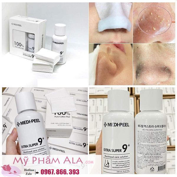u-mun-medi-peel-blackhead-care-solution-600x600